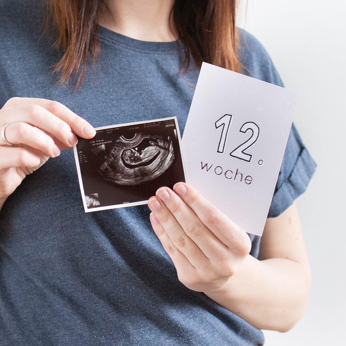 Babyglück – Meilensteinkarten Schwangerschaft – Bild 7